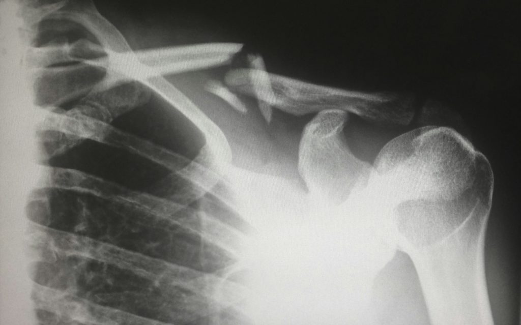 How Startups Can Prepare for Personal Injury Lawsuits: A Comprehensive Guide