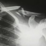 How Startups Can Prepare for Personal Injury Lawsuits: A Comprehensive Guide