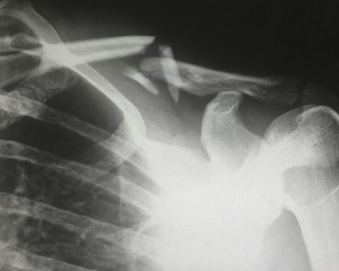 How Startups Can Prepare for Personal Injury Lawsuits: A Comprehensive Guide