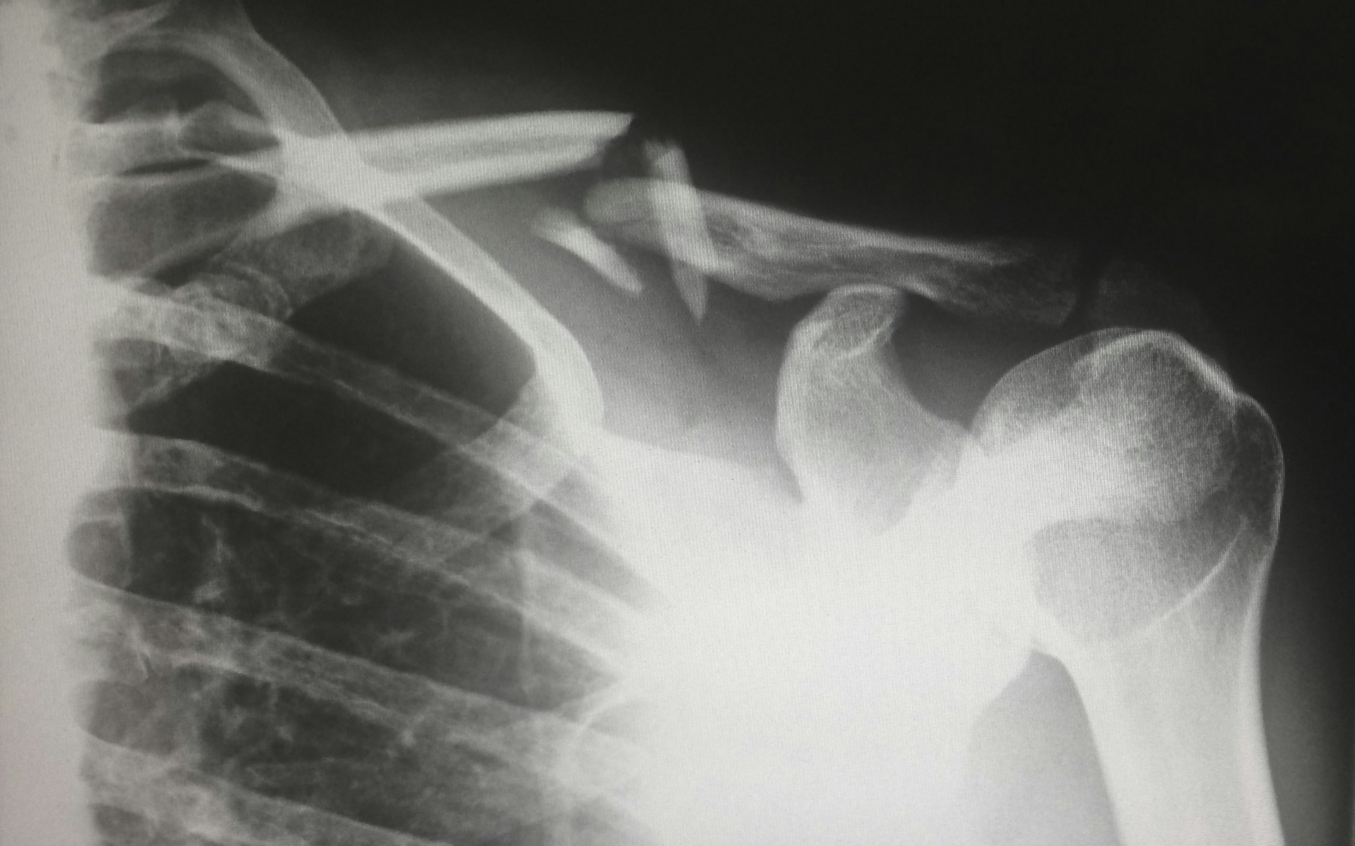 How Startups Can Prepare for Personal Injury Lawsuits: A Comprehensive Guide